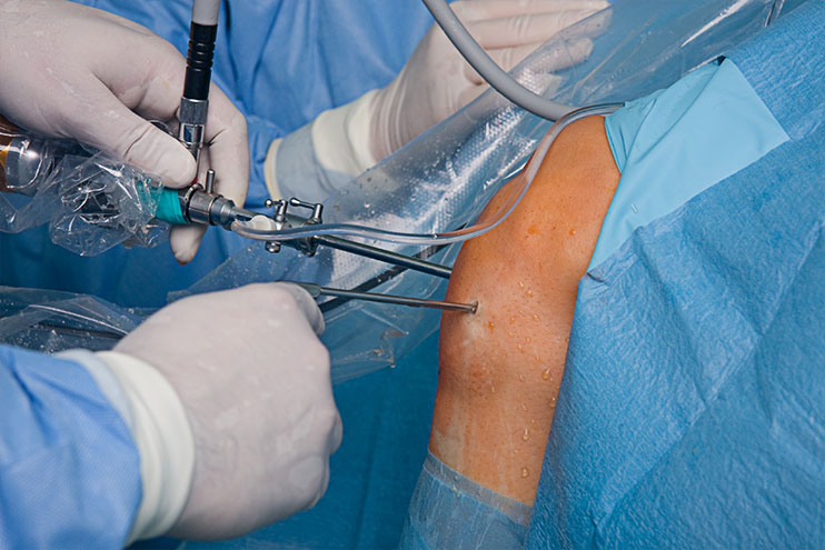 Arthroscopy center in nagpur