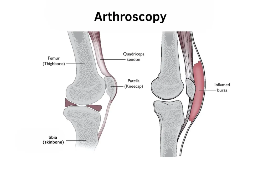 Best arthroscopy specialist doctor in gondia