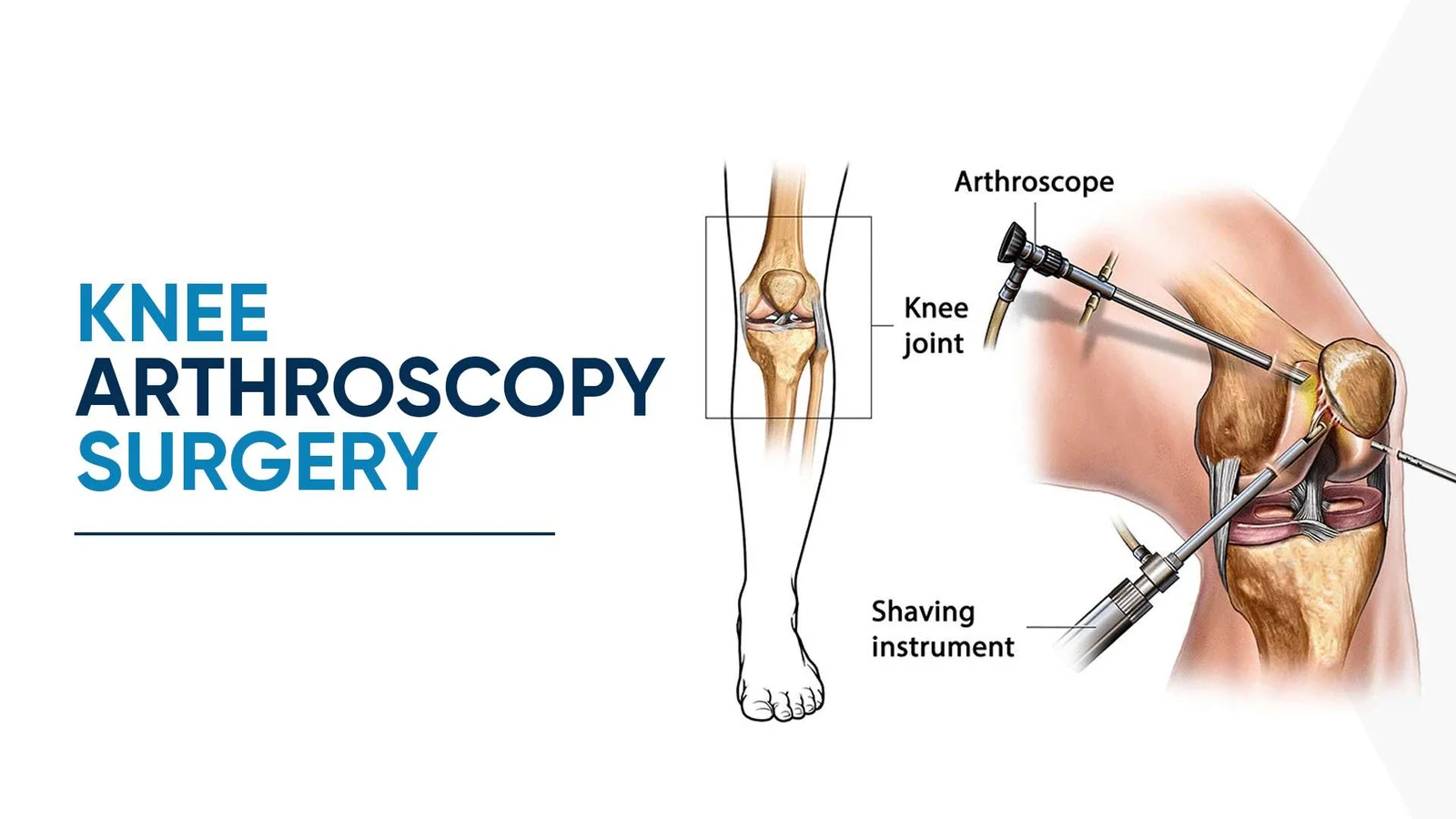 Best arthroscopy specialist doctor in seoni