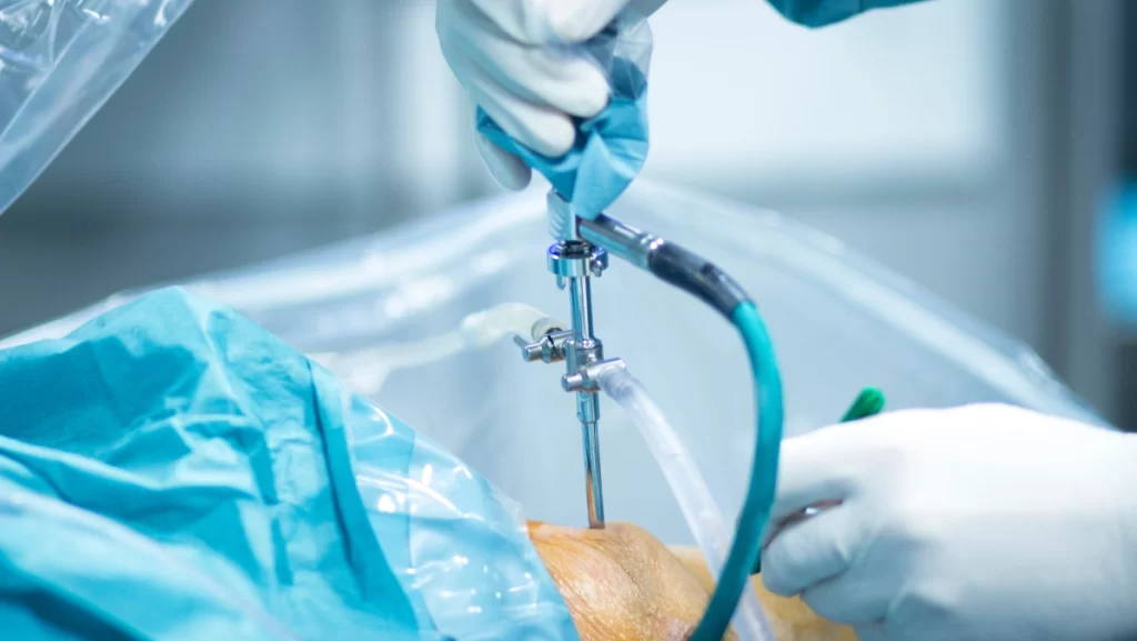 Best arthroscopy specialist doctor in chhindwara