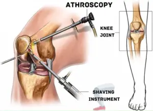 Best arthroscopy specialist doctor in sagar