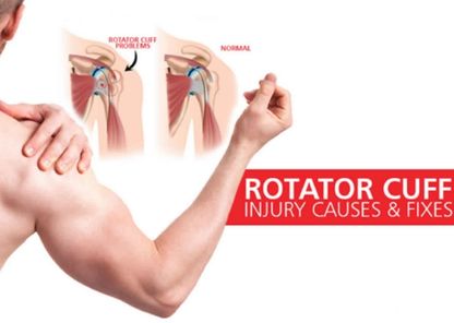 Rotator cuff surgeon in hoshangabad(Narmadapuram)