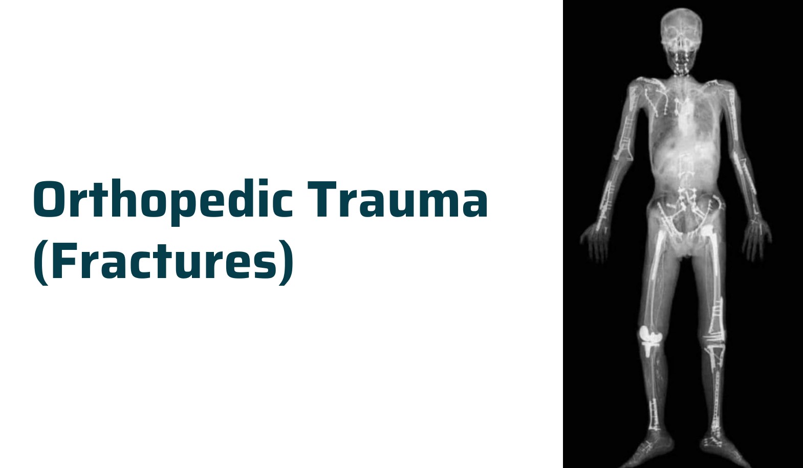 Trauma and fracture surgery in nagpur