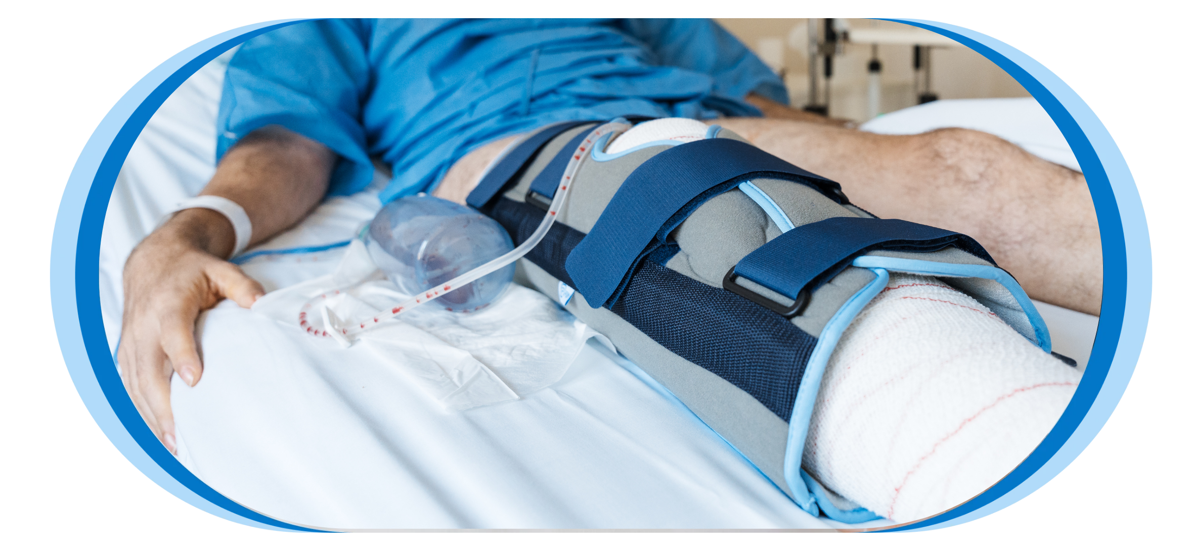 Ligament Reconstruction